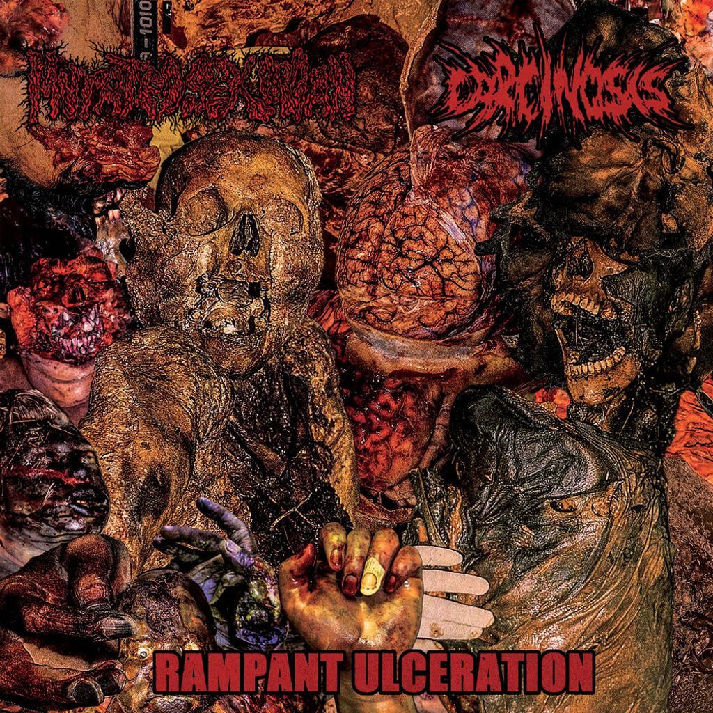 Rampant Ulceration